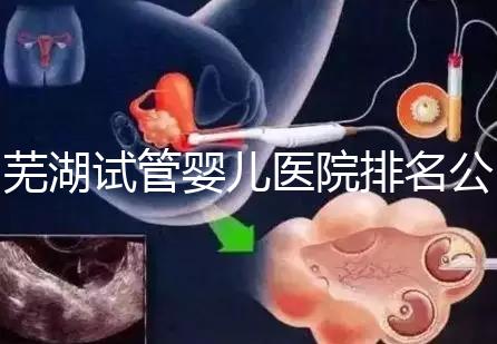 蕪湖試管嬰兒醫(yī)院排名公開,弋磯山醫(yī)院、蕪湖二院獲好評