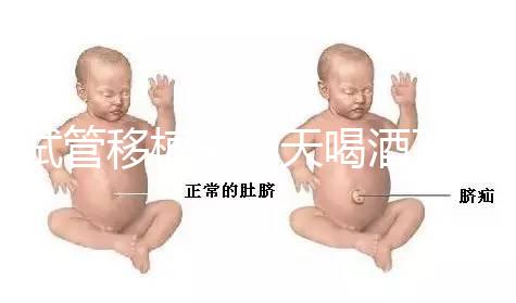 試管移植前幾天喝酒了有影響嗎?想要懷孕得管住嘴!