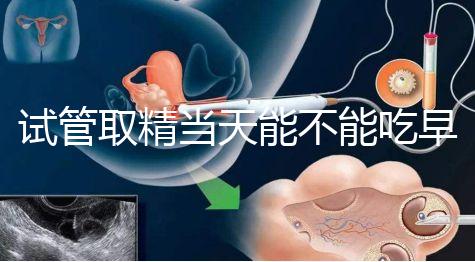 試管取精當天能不能吃早餐喝水的答案來咯咯，好不好一看就知道了？