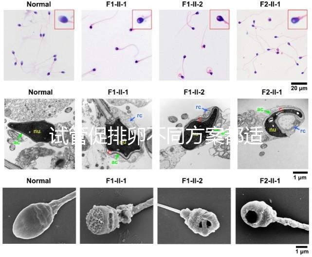 試管促排卵不同方案都適合哪些人？如何監測排卵？