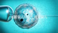 試管嬰兒現(xiàn)狀(試管嬰兒現(xiàn)狀如何)