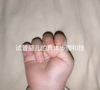 試管嬰兒的具體步驟和技術(shù)細(xì)節(jié)(試管嬰兒的具體步驟和技術(shù)細(xì)節(jié)是什么)