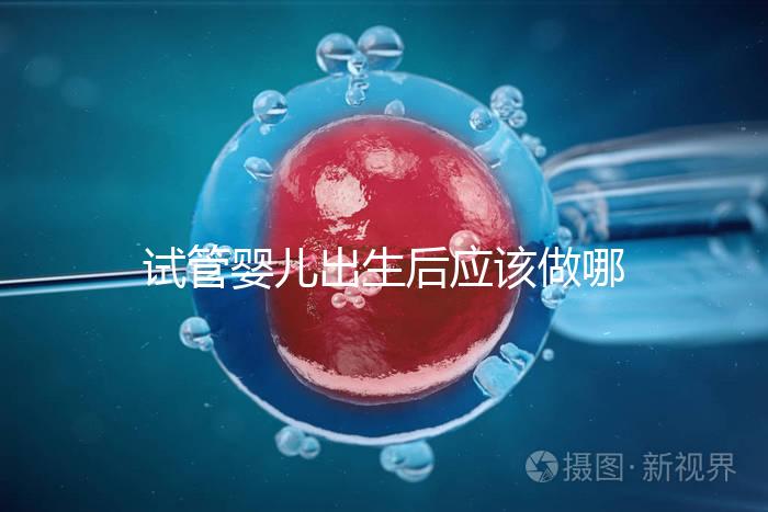 試管嬰兒出生后應該做哪些檢查答案？DR應該看情況嗎？