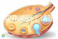 試管嬰兒減胎(試管嬰兒減胎最佳時間)