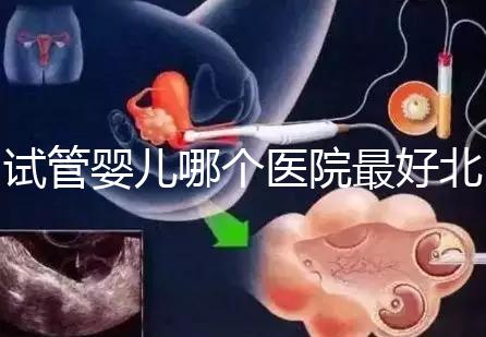 試管嬰兒哪個醫(yī)院最好北京(試管嬰兒北京哪個醫(yī)院做的好)