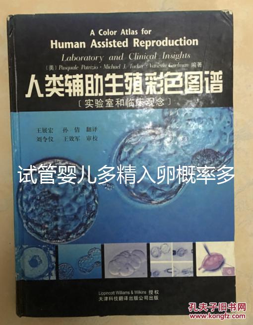 試管嬰兒多精入卵概率多少難說，比正常配對低別瞎操心