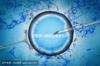 試管嬰兒建檔需要多長時間進來瞧,內含詳細流程供參考