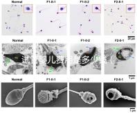 試管嬰兒費(fèi)用是多少錢(試管嬰兒費(fèi)用是多少錢一次)