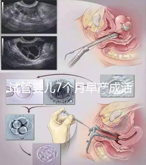試管嬰兒7個月早產成活率高達80%！能不能要看身體狀況