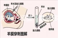 過來人的經驗：囊胚移植第13天少量出血未必是壞事