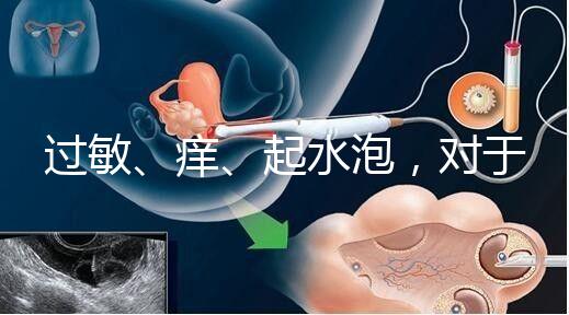 過敏、癢、起水泡，對于三伏貼的副作用你需知道該怎么辦