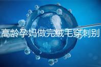 高齡孕媽做完絨毛穿刺別著急上班，臥床休息時間得這么久