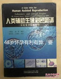 48歲懷孕有利有弊,要不要生需考慮這3點(diǎn)!