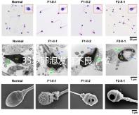 33歲卵泡發育不良，做試管黃體期促排方案失敗怎么辦？