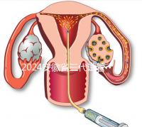 2024安徽省三代試管嬰兒醫(yī)院大全，不再只有安醫(yī)附院一家