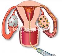 2024武漢免費葉酸外國人可以領取，符合條件就來江漢區